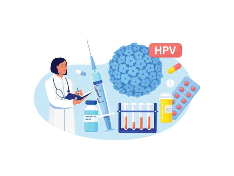 زگیل تناسلی