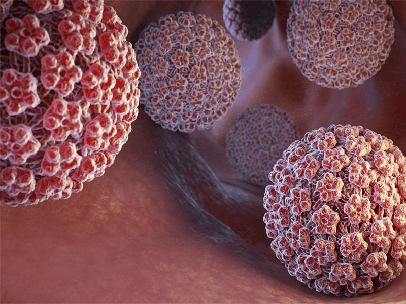 زگیل تناسلی